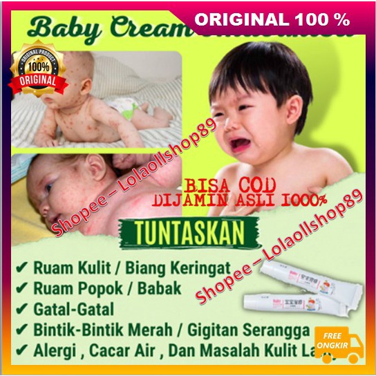 [BISA COD] Salep Gatal Eksim Khusus Bayi 100% ORIGINAL
