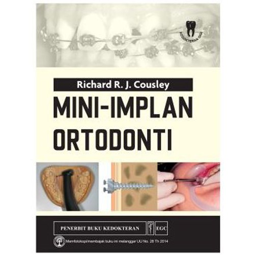 Mini-Implan Ortodonti - egc
