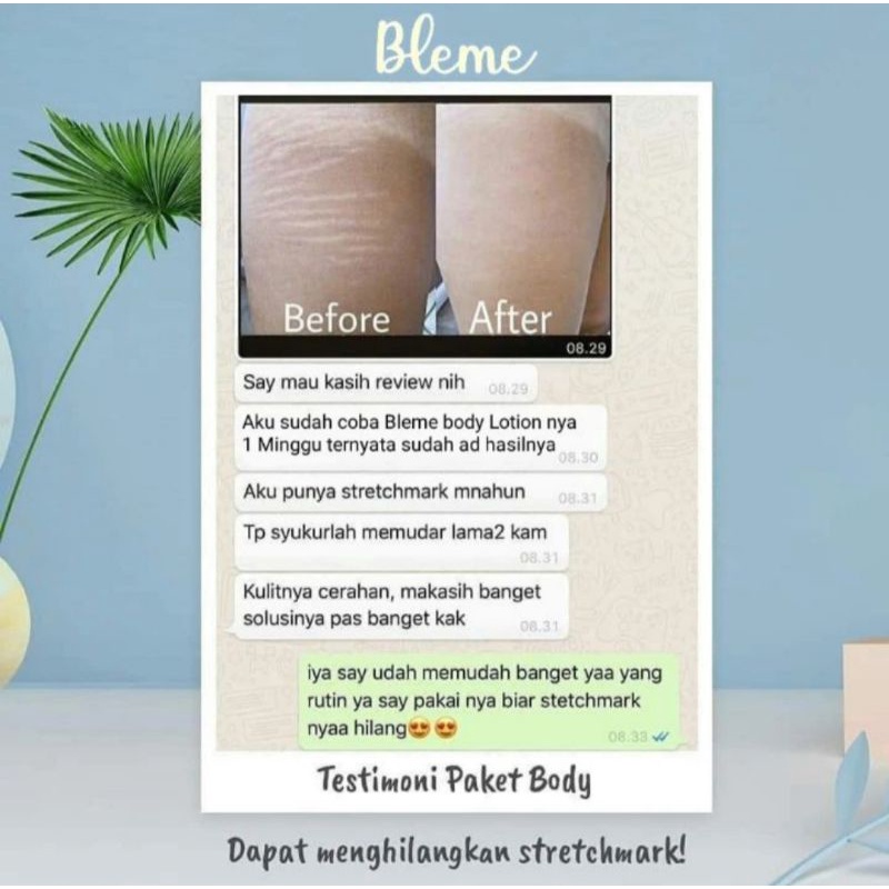 BLEME BODY LOTION ORI WHITENING HAND BODY BLEME LOTION BLEME 100% ORI BPOM / BLEME BODY LOTION |SERUM BLEME &amp; BODY LOTION  BLEME 100% ORIGINAL  Mencerahkan &amp; Sosuli Kulit Putih &amp; Awet Muda