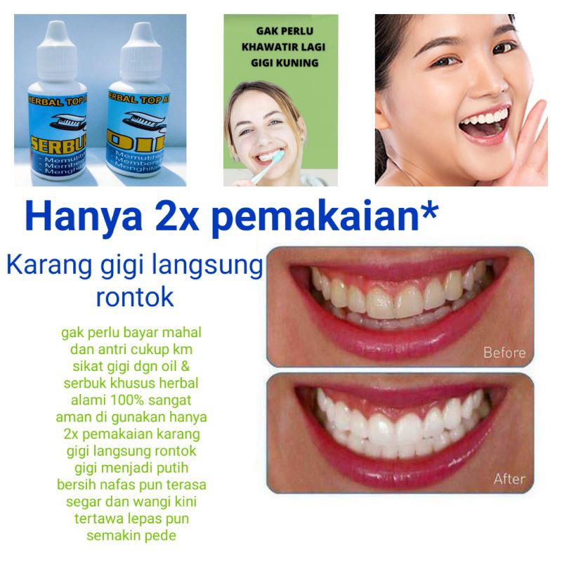 

PERONTOK KARANG GIGI / PEMUTIH GIGI KUNING 100% AMPUH