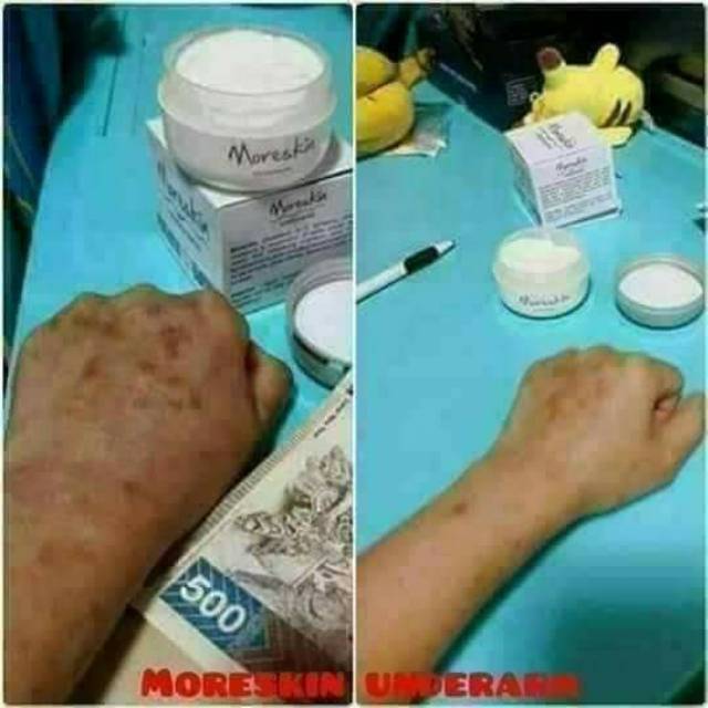 Moreskin underarm