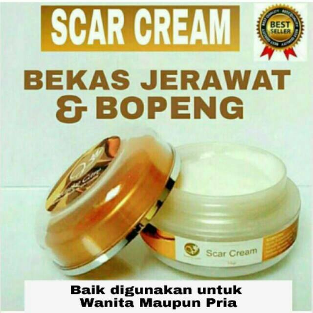 Scar Cream Bopeng dan Bekas Jerawat V Beauty Care Victory Beauty Care