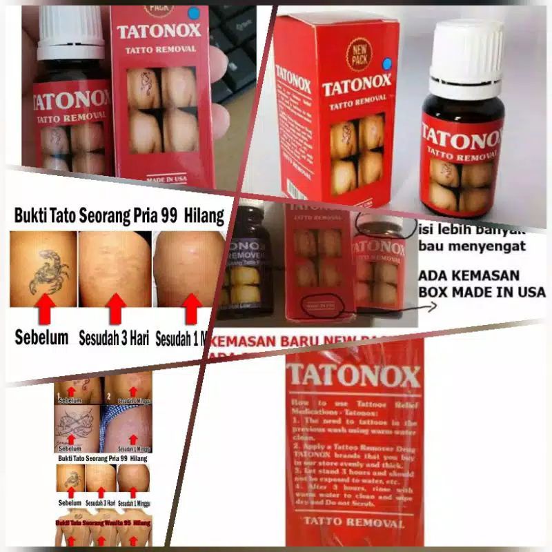 

TATONOX PENGHAPUS TATO PERMANEN