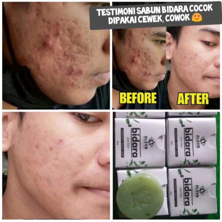 [BISA COD] Sabun Bidara Sabun Pemutih Wajah Bidara Kelor Aleya Whitening Soap Glowing Sabun Muka Obat Flek