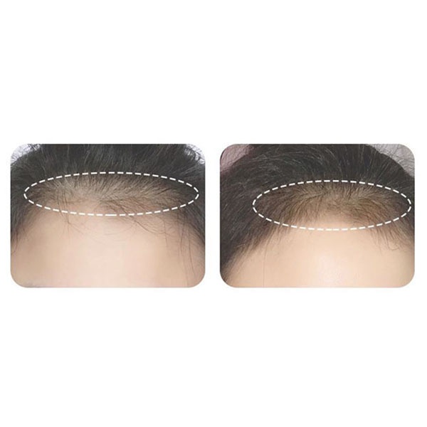 hair shadow hairline powder bedak rambut hig094 (4I2)