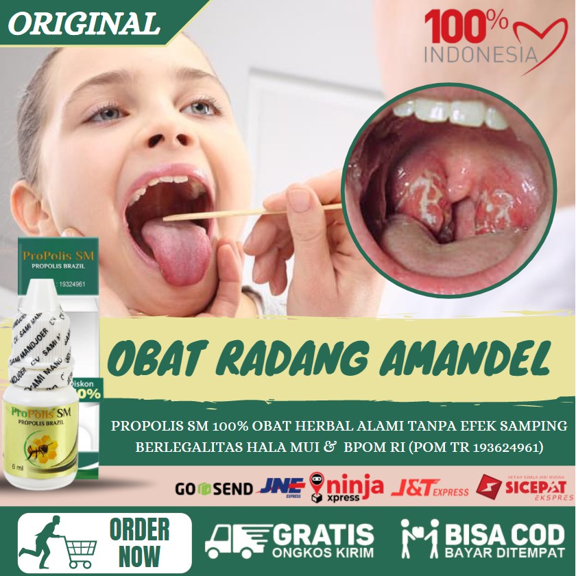 OBAT HERBAL AMANDEL KRONIS - RADANG TENGGOROKAN - SAKIT TENGGOROKAN - PROPOLIS SM ASLI [ BISA COD ]