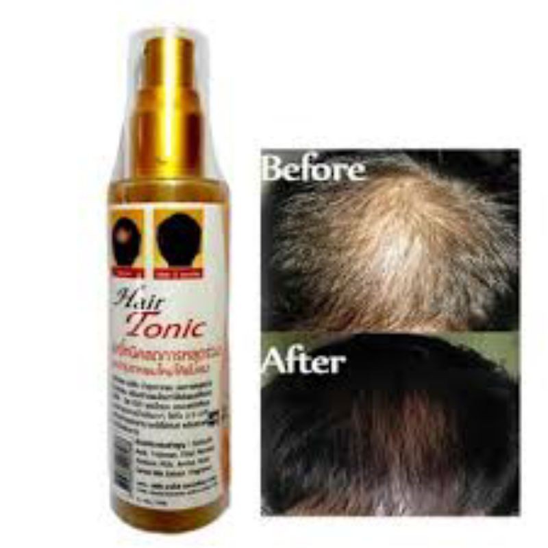 (READY) GENIVE HAIR TONIC Penyubur Rambut ORIGINAL THAILAND