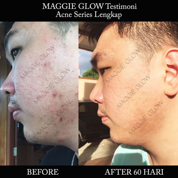 Big Deals MAGGIE GLOW ACNE FACIAL WASH BPOM NA18161204142 kualitas TINGGI