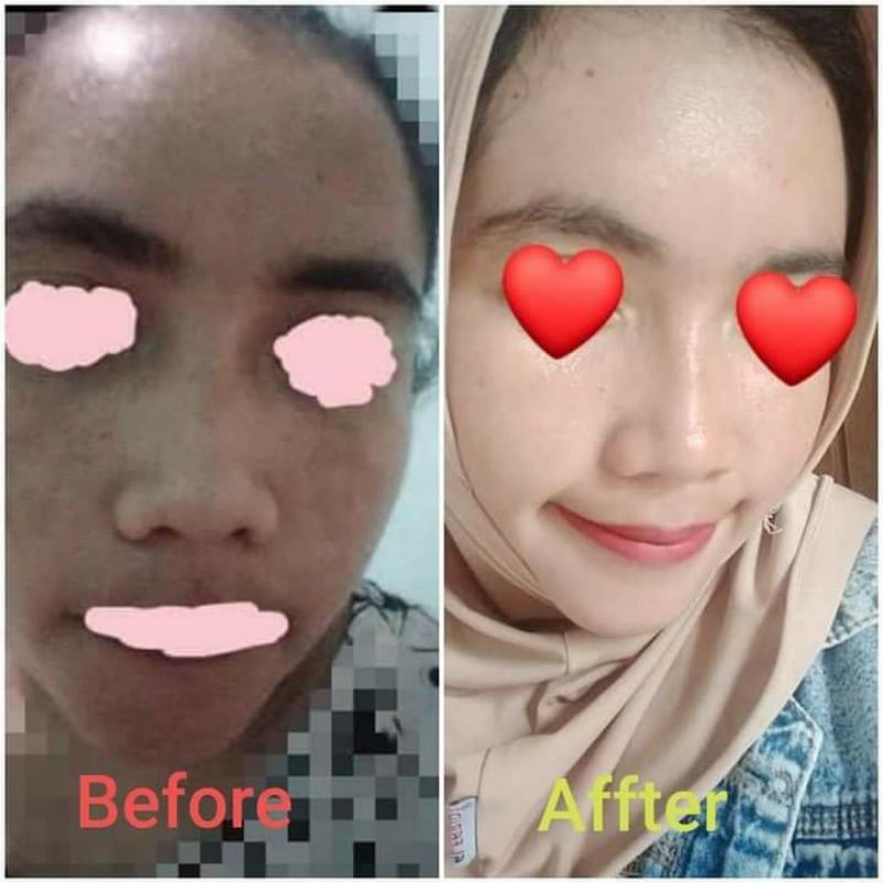 Ratu Glow Skincare Original BPOM paket acne brightening jerawat flek kusam Lo