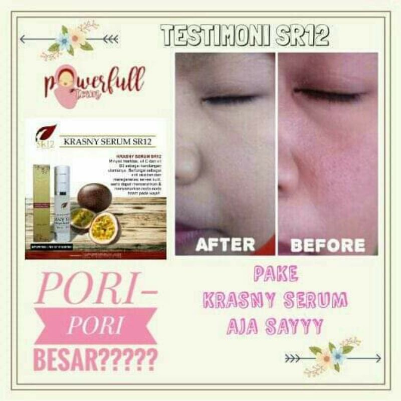 SR12 KRASNY SERUM - SERUM VIT C / SERUM KULIT KERING / SERUM MARKISA BPOM