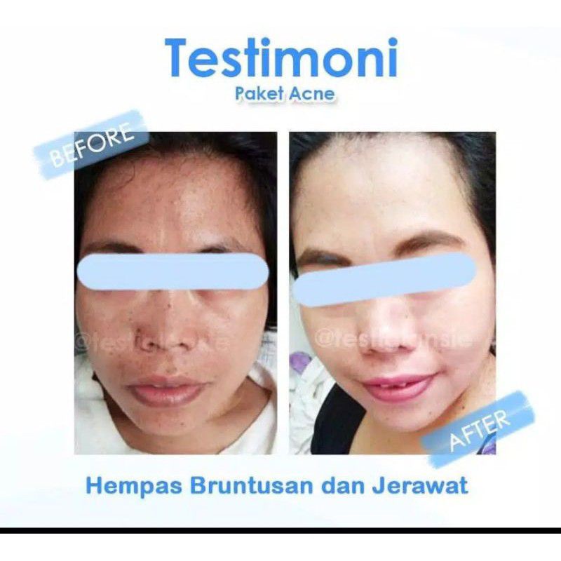 Sabun Glowing Penghilang Jerawat Bruntusan Noda Hitam Wajah Glowing Bebas Flek Hitam Sabun CDA 1000% Ori