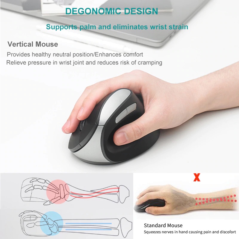 Rapoo MV20 Wireless Vertical Mouse Ergonomic 3 DPI Optical Sensor