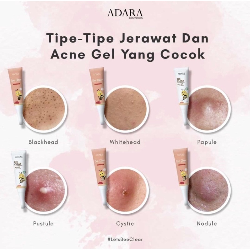 ADARA - Bee Clear Acne Gel With Bee venom / Obat Totol Jerawat