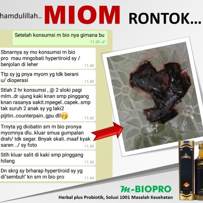 

TERMURAH M-bioPro| obat herbal miom ampuh | obat miom /OBAT HERBAL ASAM URAT/OBAT HERBAL PELANGSING/OBAT HERBAL KOLESTEROL/OBAT HERBAL DIABETES