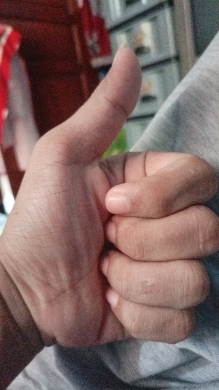 Kompor Gas Rinai Sni Garansi Resmi Stove Asli 1 Tungku Ri-511e Sni Tebal Kuat Original