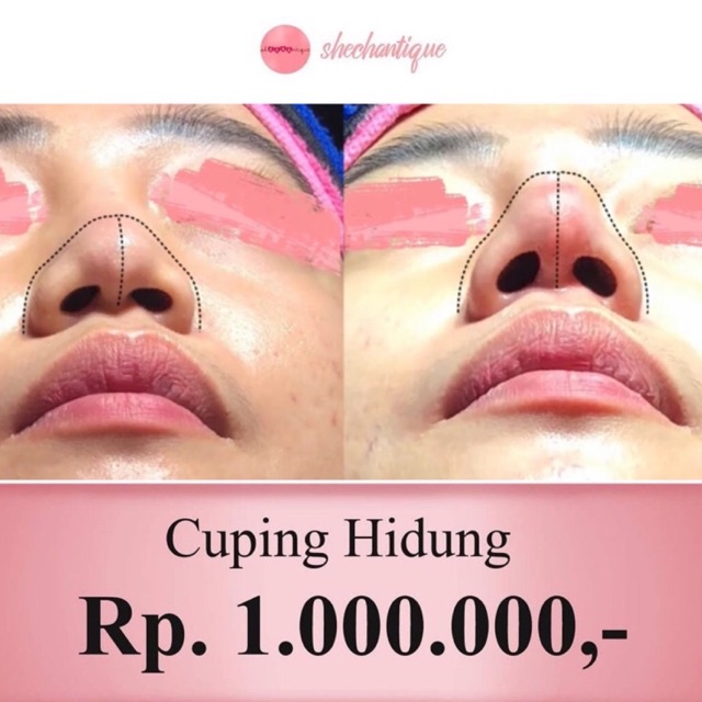 Cuping Hidung Gold Shechantique Hidung Pesek Mancung Ideal