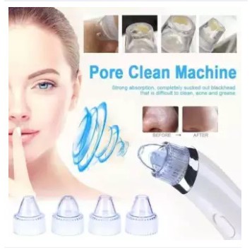 Alat Penyedot Komedo Sedot Komedo Elektrik ( XN 8030 )