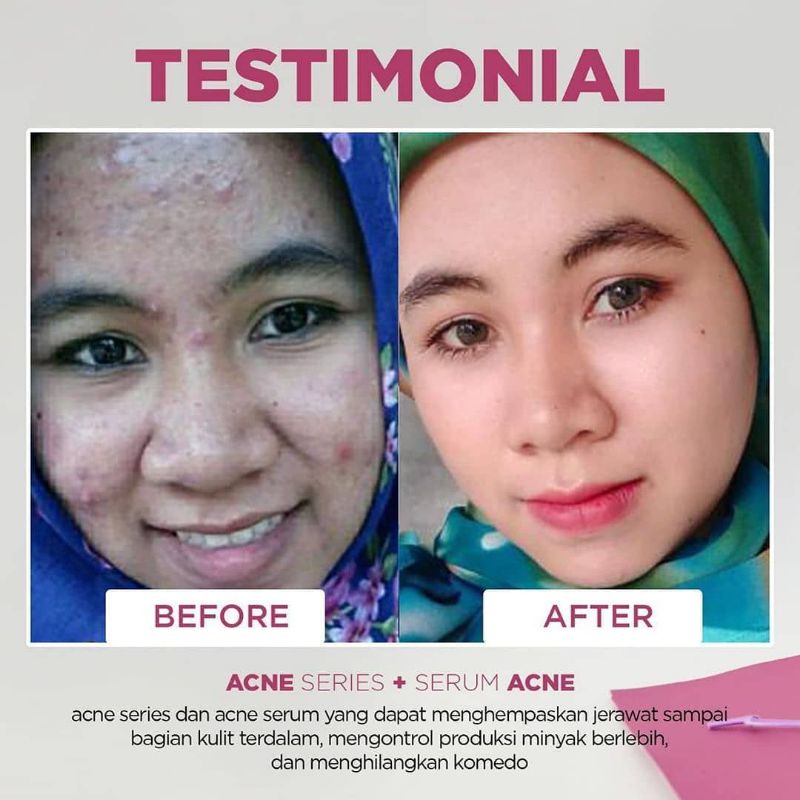 MS GLOW PAKET WAJAH MS GLOW MS GLOW MURAH PAKET ACNE  PAKET MS GLOW