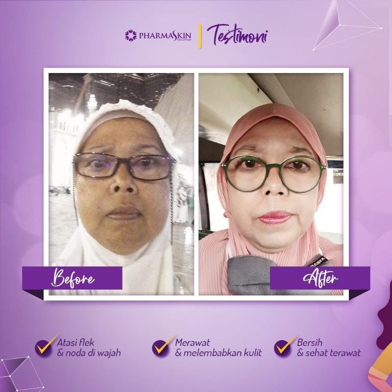 Pharmaskin Paket Skincare Intensive Night Cream Flek Hitam Menahun Perawatan Wajah Menghilangkan Noda Hitam Resmi Halal BPOM Ampuh Original-8