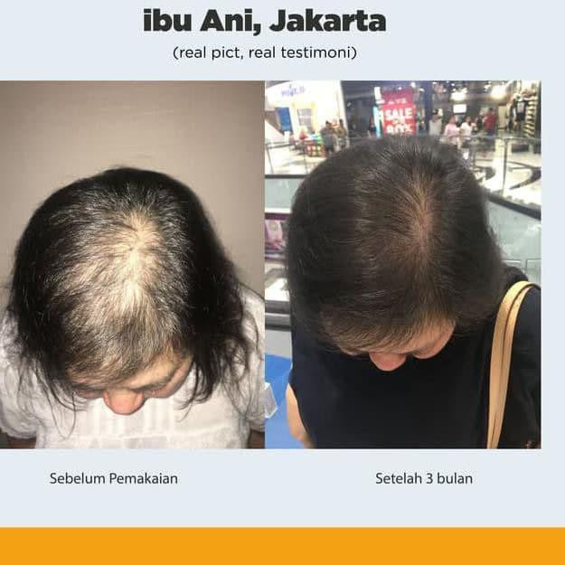 STAR BRANDS AVALIN Booster Hair Growth Oil Serum (FREE BONUS) Penumbuh Penyubur Penebal Rambut  15ml