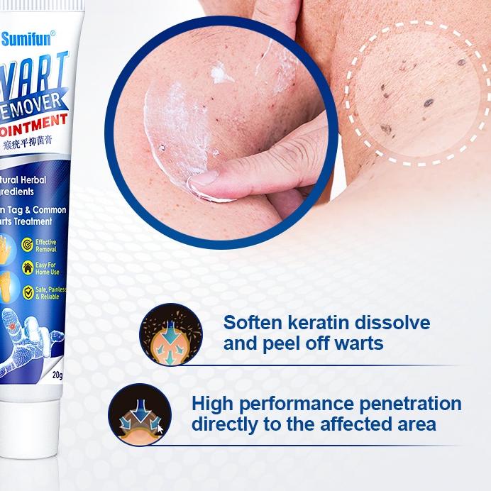 ☻ Warts Remover Cream Wart Treatment Skin Tags Mole Remover Plaster Cream Antibacterial Foot Wart Oi