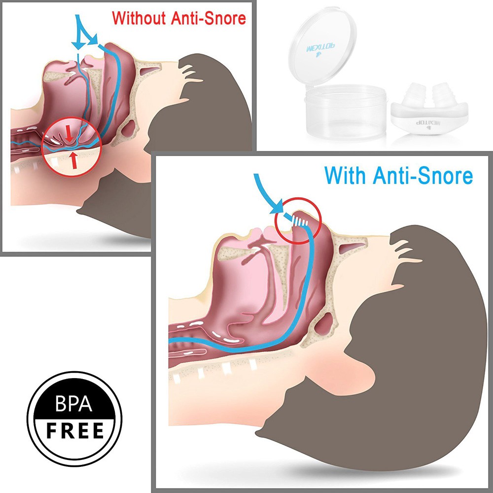 Anti Ngorok Pernafasan Hidung Stop Snoring Solution - MX-555 - OMHR9XBL Blue