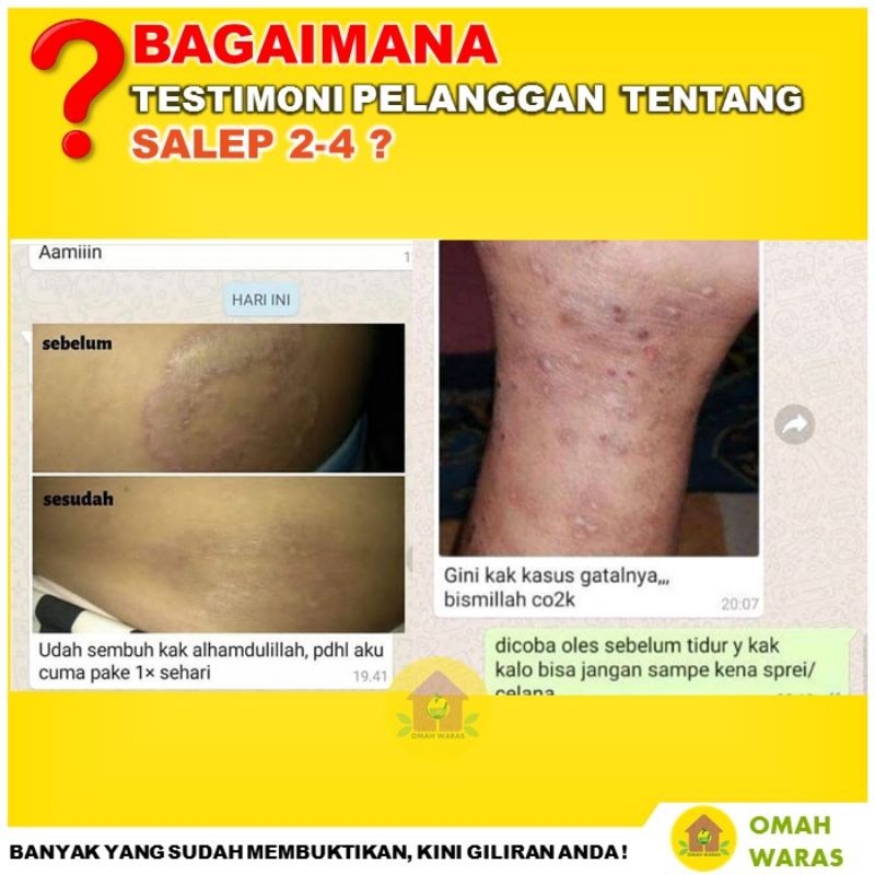 salep krim belerang anti gatel salep kurap panu scabis original