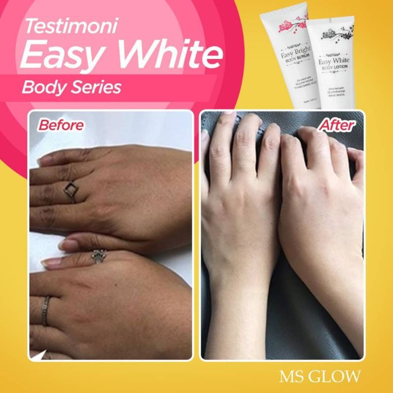 MS Glow Hand Body 100% original bisa cod