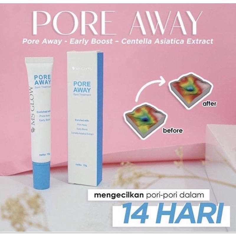 (READY STOCK BARU) MS GLOW TREATMENT SPOT ACNE SPOT / DARK SPOT / PORE AWAY