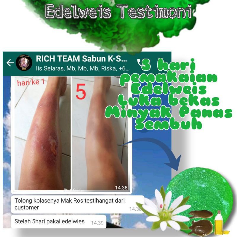 Sabun Bulus Edelweis K-Selaras