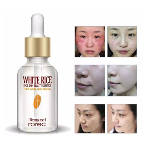 SERUM EHITE RICE ROREC / SERUM BERAS SERUM PEMUTIH WAJAH - ANTI AGING - WAJAH BERUNTUSAN