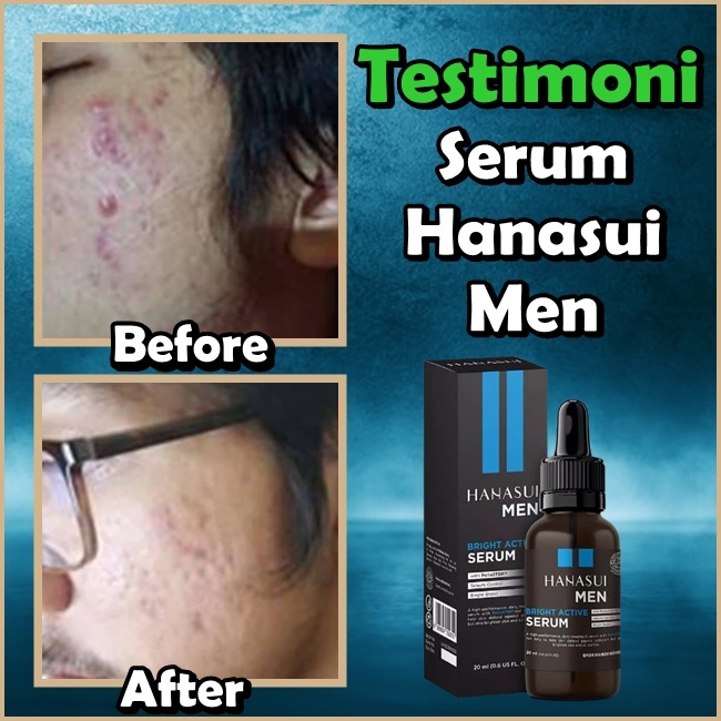 𝐑𝐀𝐃𝐘𝐒𝐀 - HANASUI Men Bright Active Serum 20ml Serum Wajah Pria