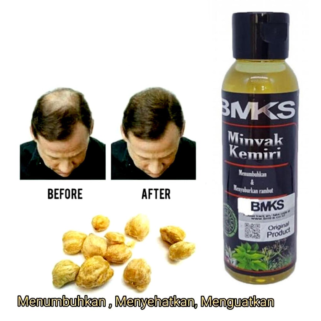 [COD] Minyak Penyubur Rambut 5 Hari | Perangsang Bulu Rambut Wajah dan Kepala | BMKS BPOM