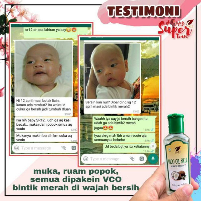 MINYAK VCO / VCO SR12 / MINYAK KELAPA ASLI / VIRGIN COCONUT OIL (VICO) SR12 Untuk Perawatan Kecantikan, memelihara Kesehatan dan untuk Pengobatan