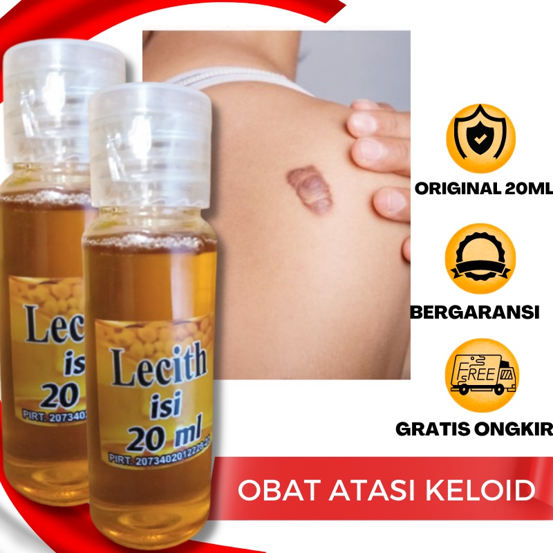 Minyak Obat Penghilang Keloid Yang Sudah Lama Luka Bakar Bagus Scar Krim Keloid Salep Serum Obat Pen