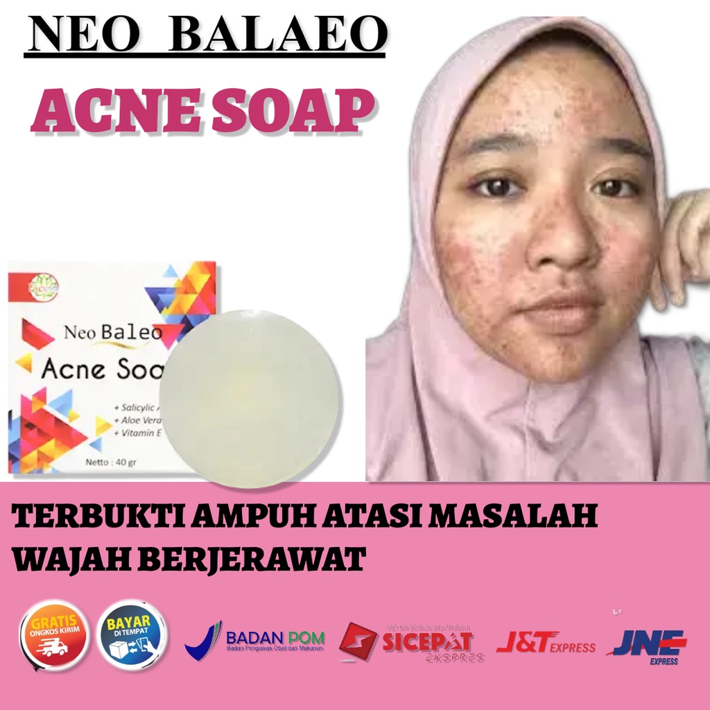 Sabun Jerawat dan Bekas Jerawat Neo Baleo Acne soap