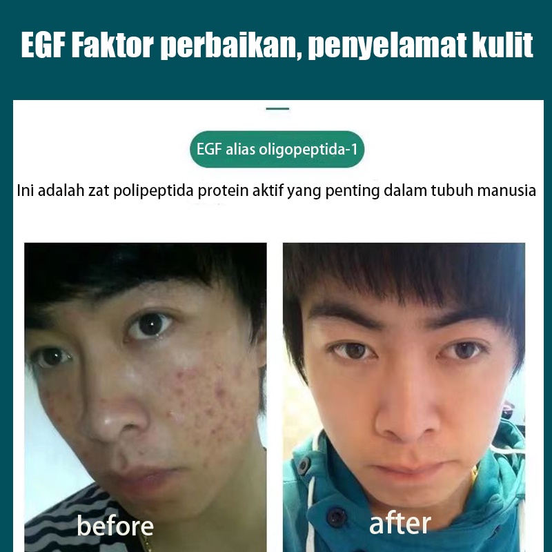 Face Wash Pembersih Muka Pria 150g Pembersih Wajah Menghilangkan Jerawat/Komedo/Kontrol Minyak 100% Asli Bopm