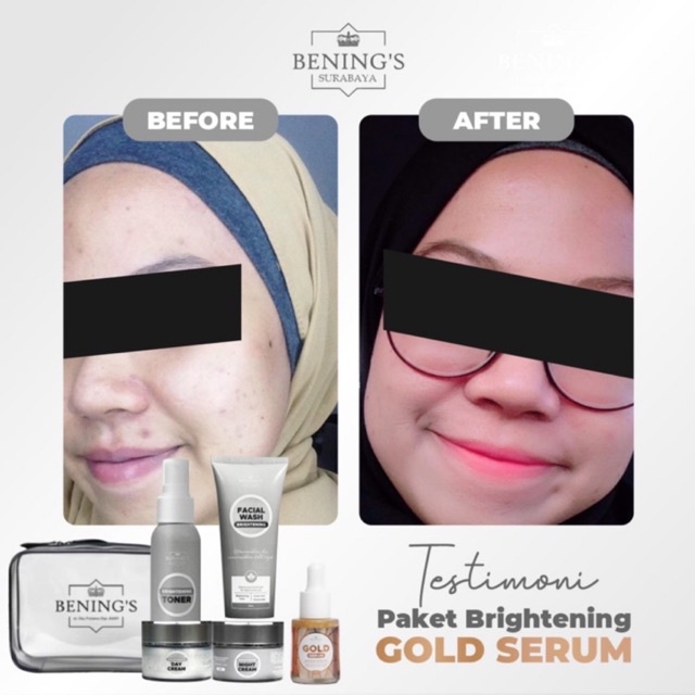 BENING'S PAKET BRIGHTENING | MENCERAHKAN &amp; MENGATASI KULIT KUSAM