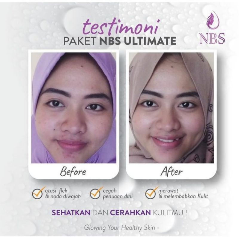 Paket Nbs Ultimate New Glowing Your Healthy Skin paket kecantikan dan pembersih wajah nbs