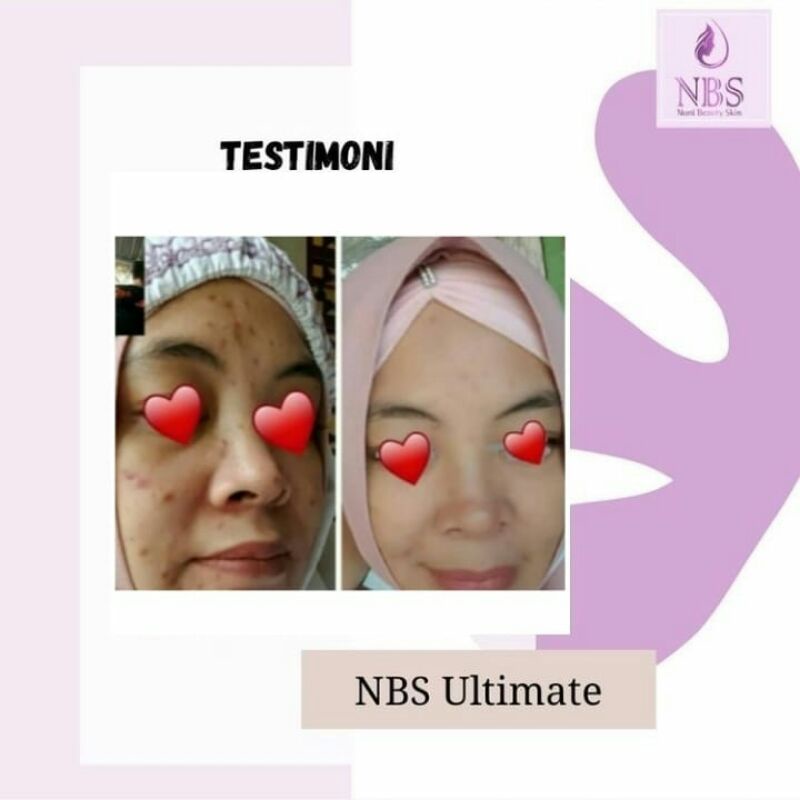 NBS NIGHT CREAM AMAN BUMIL BUSUI BPOM GLOWING PEMUTIH BEAUTY