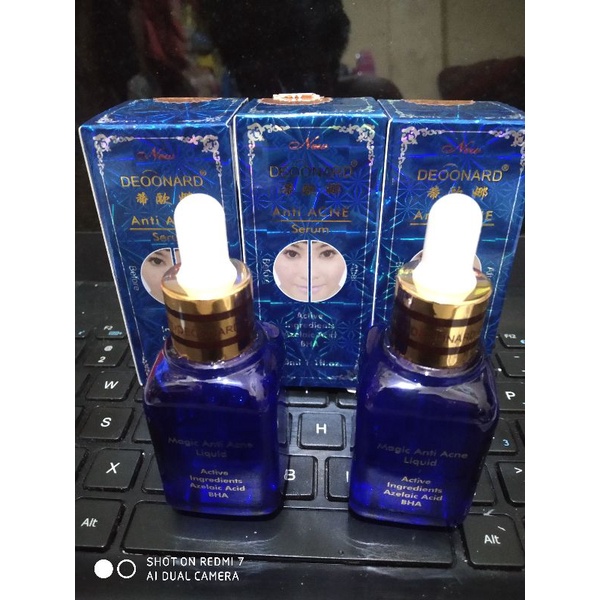 SERUM DEOONARD BIRU ANTI-ACNE ORI BPOM // serum deonard biru anti acne 30ml