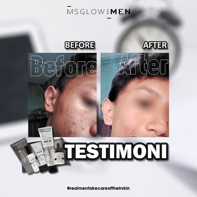 PAKET COMPLETE MS GLOW FOR MEN