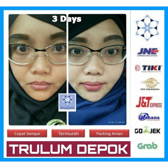 Terpopuler Cream Resmi Internasional Trulum Pemutih Wajah Pemutih Wajah Bpom Terlaris