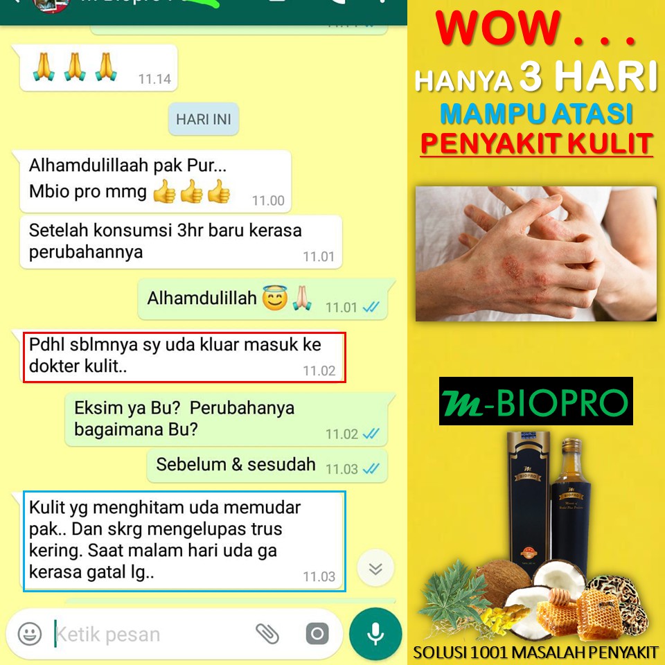 TERBUKTI  M BIOPRO Obat Gatal Gatal Alergi | M BIO PRO Obat Alergi Gatal | Obat Gatal Gatal Ampuh
