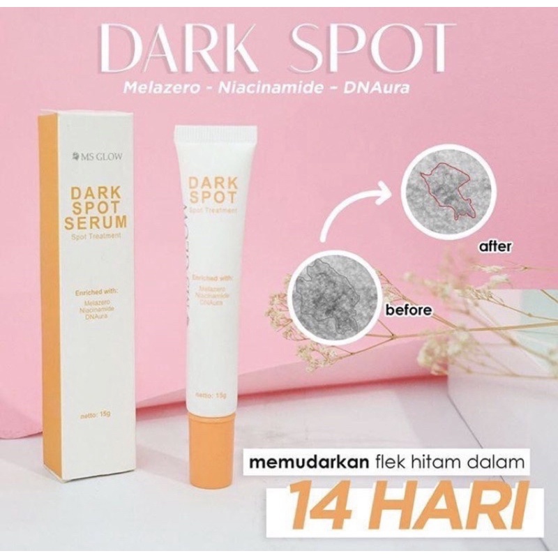 (READY STOCK BARU) MS GLOW TREATMENT SPOT ACNE SPOT / DARK SPOT / PORE AWAY