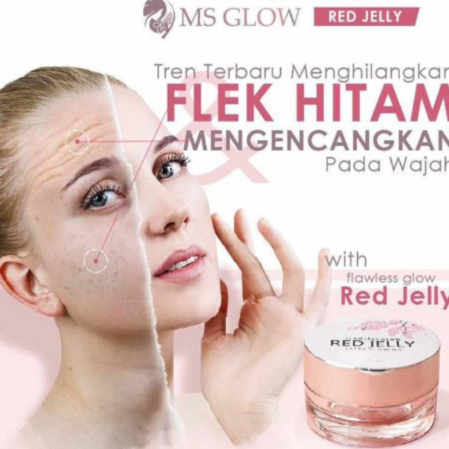 

Gel colage
