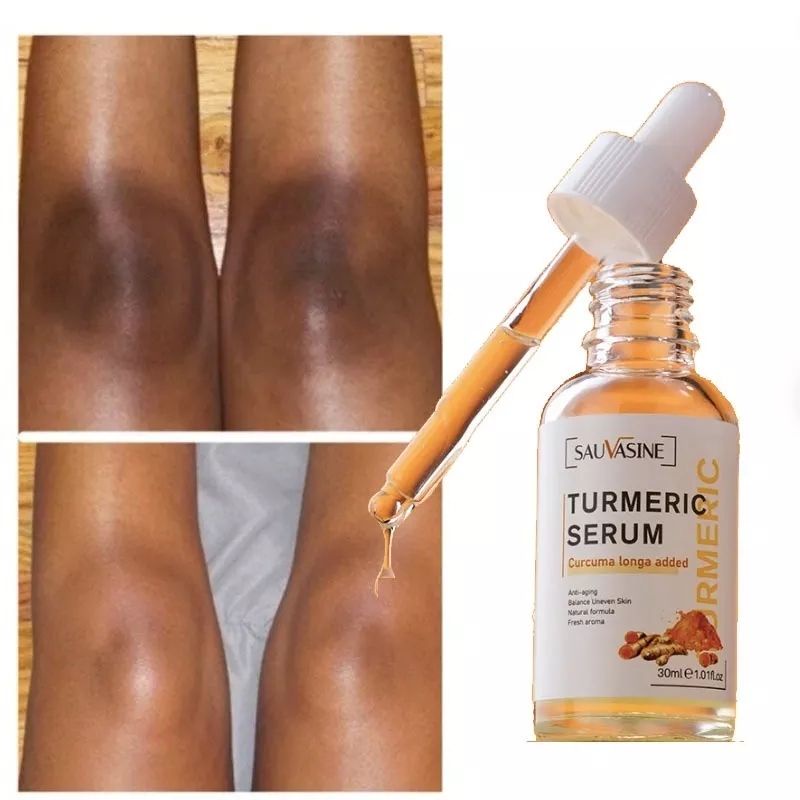 tumeric serum anti aging mencerahkan kulit hitam glowing skin