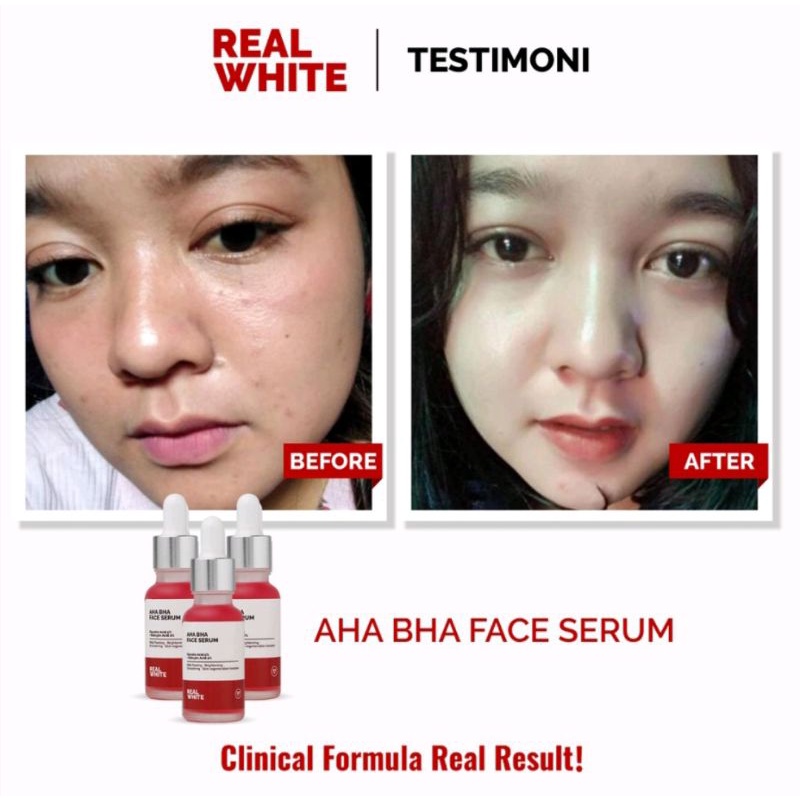 REAL WHITE AHA BHA Serum 20ml