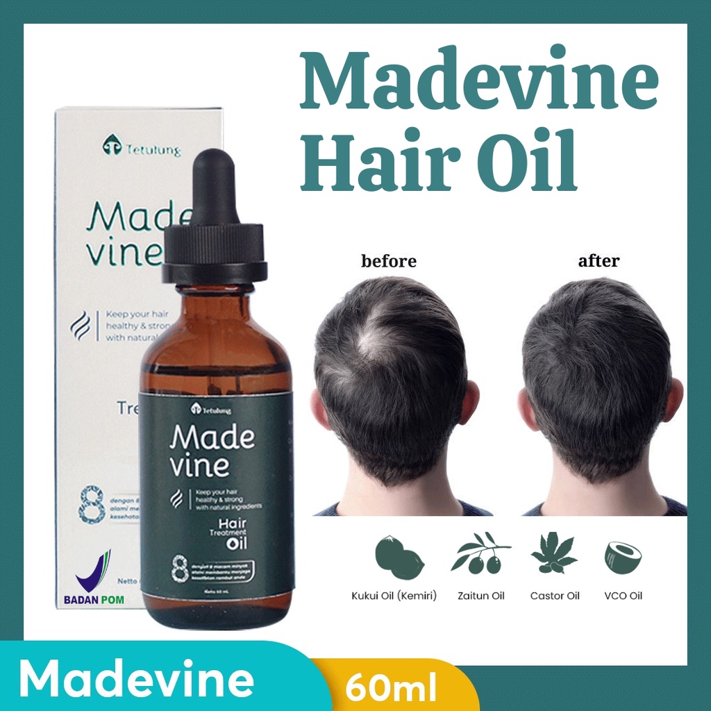 Obat Penumbuh Rambut Rontok &amp; Botak - MADEVINE HAIR TREATMENT Sudah BPOM