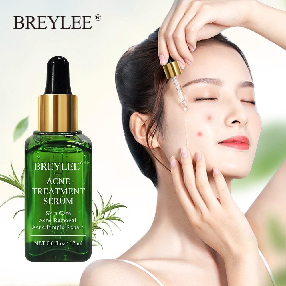 BREYLEE BE-23 Acne Serum Face Whitening Acne Scars Remover Skincare 17ml ORIGINAL